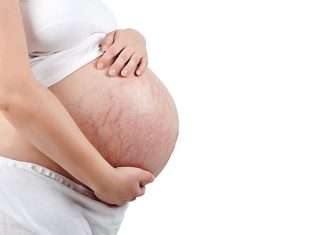 Rozstępy podczas ciąży - jak zapobiec ich powstaniu?