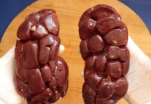 Czy nerka pasuje do sukienki?