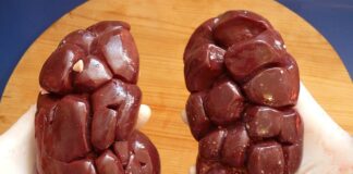 Czy nerka pasuje do sukienki?