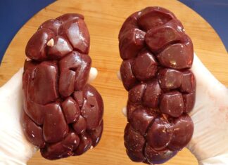 Czy nerka zalicza się do bagażu podręcznego? Czy nerka zalicza się do bagażu podręcznego?